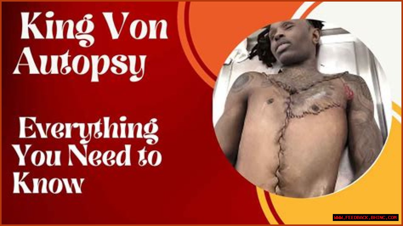 Autopsy Details On King Von's Demise: Uncovering The Tragic Truth