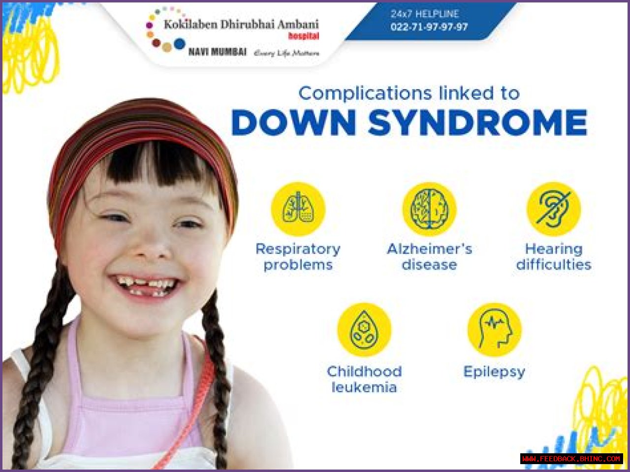 Unraveling The Mystery Of Down Syndrome
